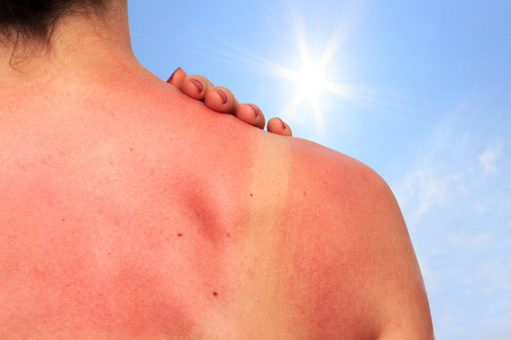 Solarium ohne schön wie werde ich braun Wie oft