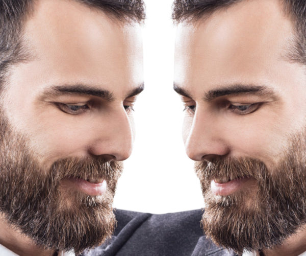 Mann im Profil vor und nach der Nasenkorrektur