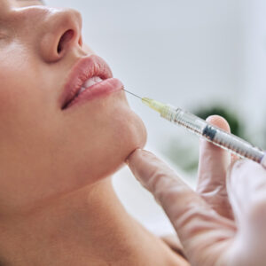Hyaluron-Behandlung an den Lippen einer Frau