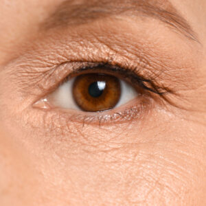 Auge einer Frau vor einer Augenlidstraffung